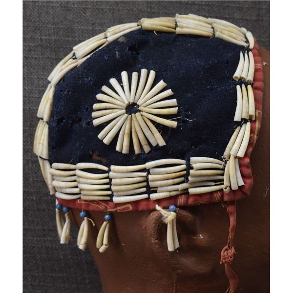 PLATEAU DENTALIUM HAT