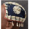 Image 3 : PLATEAU DENTALIUM HAT