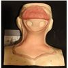 Image 1 : SILICONE BRAIN SURGERY APPLIANCE COWL ON FORM