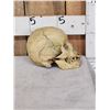 Image 2 : VINTAGE Real Human Skull Medical Teaching Specimen