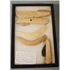 Image 1 : Riker Case: 5 bone scrapers and knives