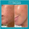 Image 6 : Paula's Choice Skin Perfecting Daily facial Exfoliator (118ml) 2% BHA Liquid Exfoliant - New!