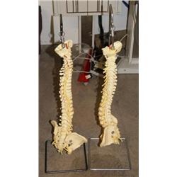 Set of two Spinal Column Displays