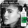Image 7 : Vichy Laboratories Anti-Dandruff Treatment Shampoo for Sensitive Scalp (390ml) - New (Broken Pump*)