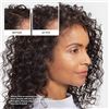 Image 5 : Nioxin Pro Clinical Hair Fall Defense Shampoo (475ml) Grows Stronger Hair/Prevents Hair Loss - New!