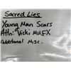 Image 2 : Screen Used Prop - "Sacred Lies" - Young Man Scars - From Bill Terezakis