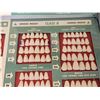 Image 8 : Vintage Vintage Trubyte New Hue Dental Prosthetic Teeth Display