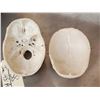 Image 6 : Vintage Authentic Human Skull Medical Teaching Specimen