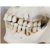 Image 5 : Authentic Human Skull Medical Teaching Specimen