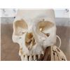 Image 8 : Authentic Human Skull Medical Teaching Specimen