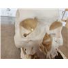 Image 9 : Authentic Human Skull Medical Teaching Specimen