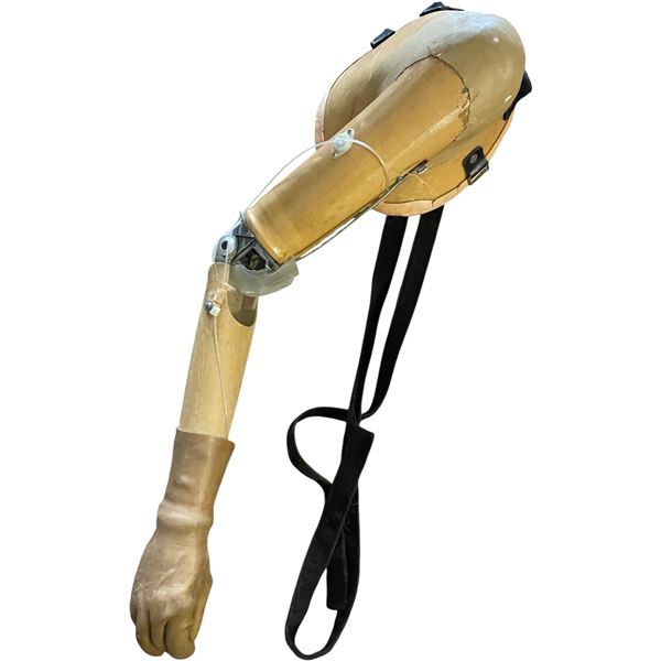 Prosthetic Arm