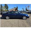 Image 7 : DUNCAN - 2002 ACURA TL BLUE 328203 KMS - D802938