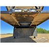 Image 9 : 2017 DOEPKER SUPER B-TRAIN GRAIN TRAILERS