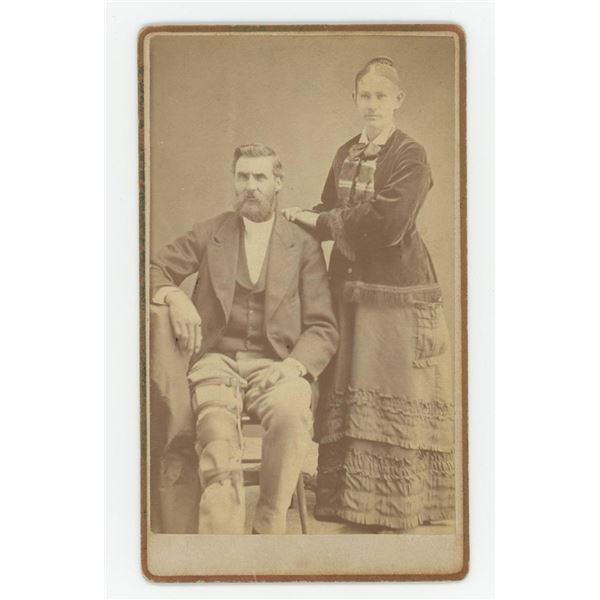 Disabled Amputee Peg Leg CDV Photo