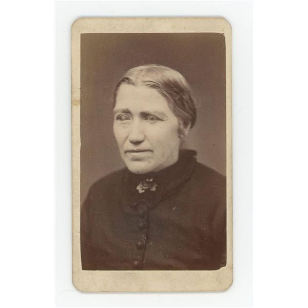 Blind Woman with Prosthetic Eye CDV Photo