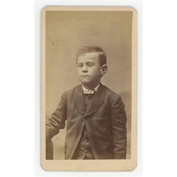 Blind Cross Eyed Child CDV Photo