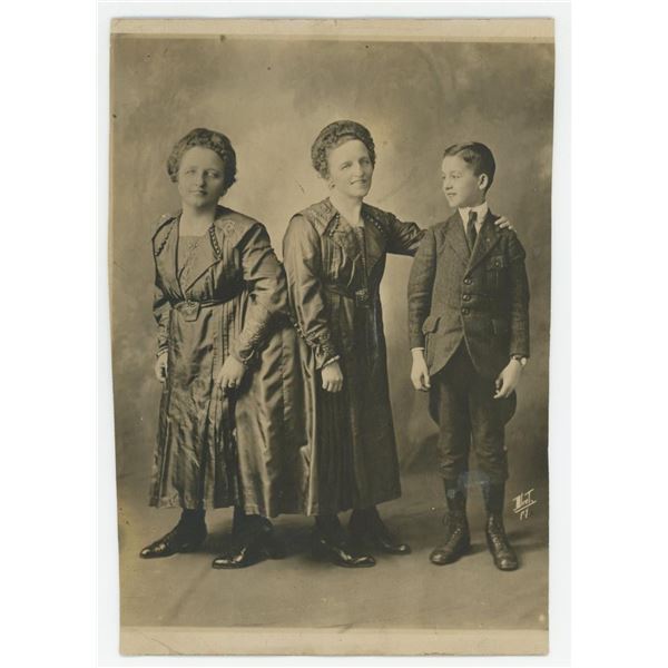 Siamese Twins Rosa Josepha Blazek Photo