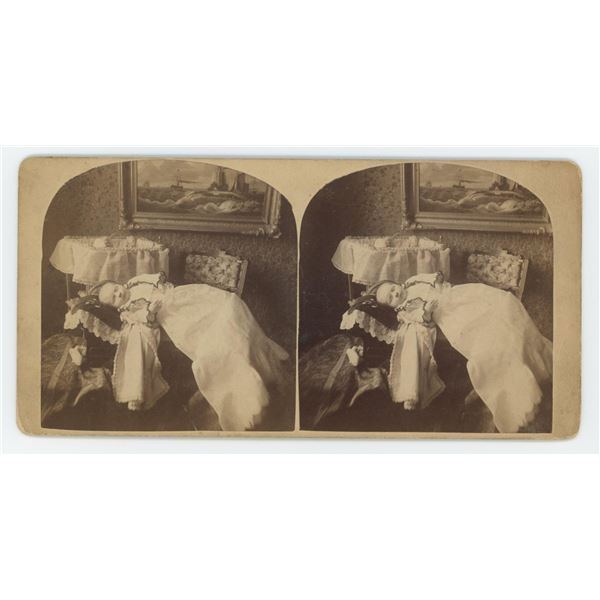 Post Mortem Baby Stereoview