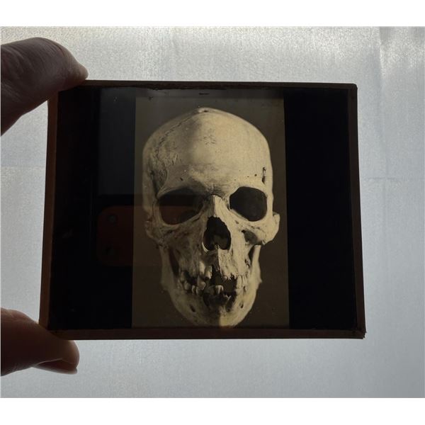 Deformed Human Skull Medical Magical Lantern Slide