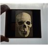 Image 1 : Deformed Human Skull Medical Magical Lantern Slide