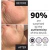 Image 6 : MyoLift True-Microcurrent Facial Device - Non-Invasive Face Lift/Anti-Aging - NEW ($300 RETAIL!)