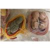 Image 3 : Group of Anatomical Fetal Development Models