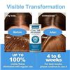 Image 5 : Lot of 2 Morovan Coal Tar Anti-Dandruff Shampoos (300ml) for Severe Dandruff, Psoriasis, Itchy Scalp