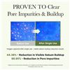 Image 8 : 2 Boxes of Arencia Pore Melt Phyto PDRN Cleansing Balm (90ml) Makeup Removing & Serum Cleansing; New