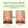 Image 9 : 2 Boxes of Arencia Pore Melt Phyto PDRN Cleansing Balm (90ml) Makeup Removing & Serum Cleansing; New