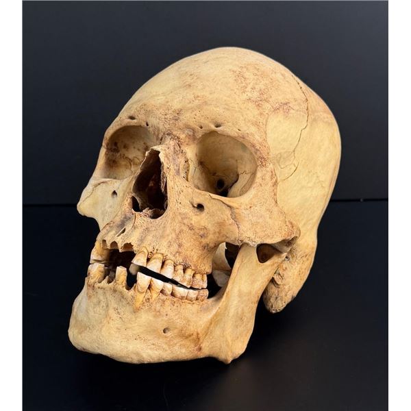 Antique Medical Male Human Skull West Eurasian
