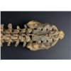 Image 13 : Antique Human Medical Spinal Column