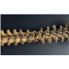 Image 14 : Antique Human Medical Spinal Column