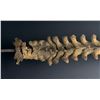 Image 16 : Antique Human Medical Spinal Column