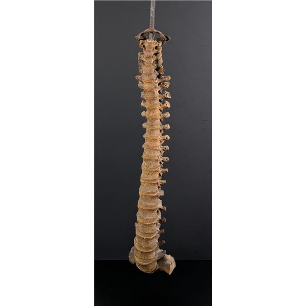 Antique Human Medical Spinal Column