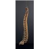 Image 5 : Antique Human Medical Spinal Column