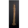 Image 6 : Antique Human Medical Spinal Column