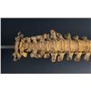Image 8 : Antique Human Medical Spinal Column