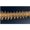 Image 9 : Antique Human Medical Spinal Column