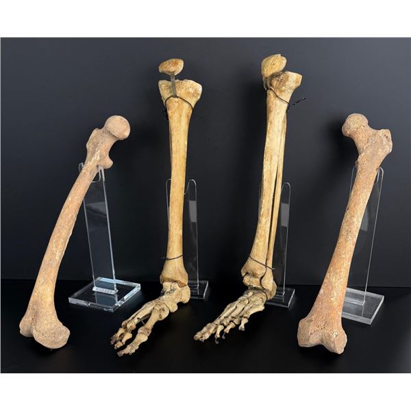 Antique Human Medical Bones Legs and Feet
