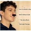Image 4 : Red Light Nasal Therapy Device/Rhinitis Laser Device for Nasal Relief/Cold/Allergy Relief - New