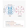 Image 3 : Brand New VEVOR 2-Pack Inflatable Bumper Balls – Red & Blue