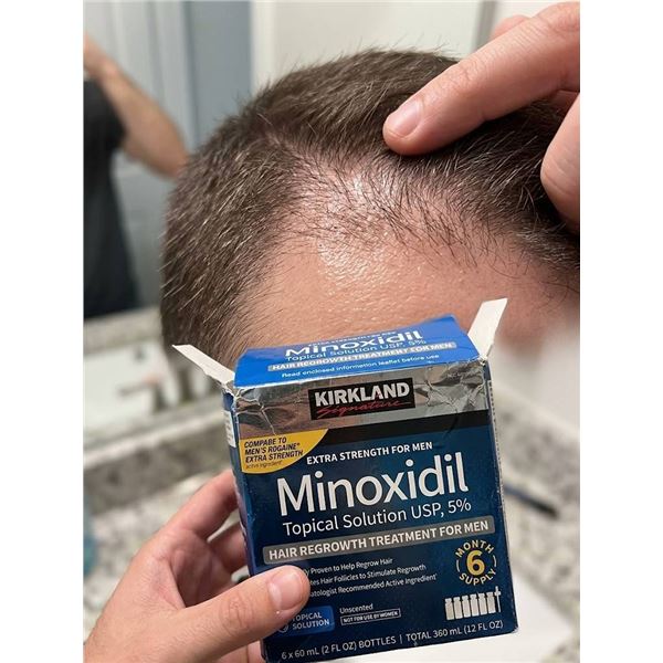 Kirkland Signature Minoxidil 5% Topical Solution