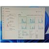 Image 4 : MINI PC THINKCENTER M720Q i5-8400t 8GB 240G NVMe WIN 11