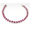 Image 9 : Exceptional Burmese Ruby