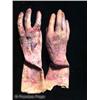 Image 4 : Nip/Tuck (2003-2010) Prosthetic Burnt Hands