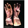 Image 5 : Nip/Tuck (2003-2010) Prosthetic Burnt Hands