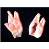 Image 2 : Nip/Tuck (2003-2010) Prosthetic Baby Hands