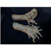 Image 2 : Nip/Tuck (2003-2010) Prosthetic Tree Hands