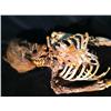 Image 7 : Nip/Tuck (2003-2010) Skeletal Remains